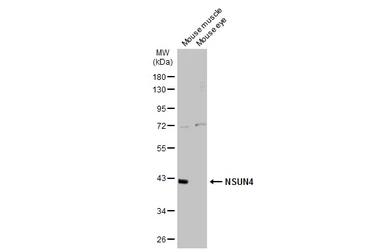 Anti-NSUN4 antibody [N1C2] used in Western Blot (WB). GTX120442