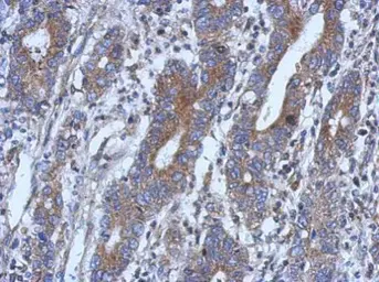 Anti-NSUN4 antibody [N1C2] used in IHC (Paraffin sections) (IHC-P). GTX120442