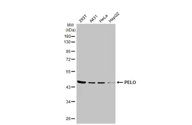 Anti-PELO antibody used in Western Blot (WB). GTX120446