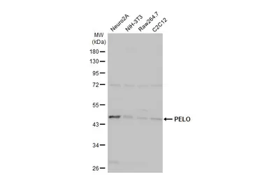Anti-PELO antibody used in Western Blot (WB). GTX120446