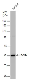Anti-AAR2 antibody used in Western Blot (WB). GTX120448