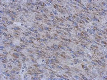 Anti-MUM1L1 antibody [N1N2], N-term used in IHC (Paraffin sections) (IHC-P). GTX120472