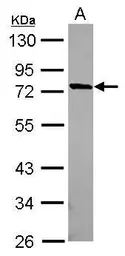 Anti-MUM1L1 antibody [N1N2], N-term used in Western Blot (WB). GTX120472