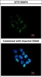 Anti-WDR12 antibody [N1C2] used in Immunocytochemistry/ Immunofluorescence (ICC/IF). GTX120474