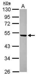 Anti-WDR12 antibody [N1C2] used in Western Blot (WB). GTX120474
