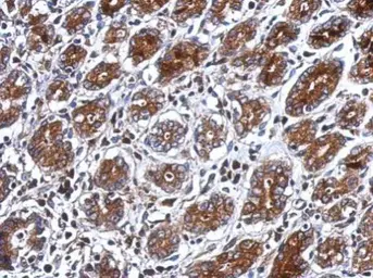 Anti-PSG3 antibody used in IHC (Paraffin sections) (IHC-P). GTX120476