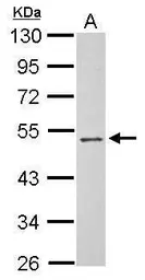 Anti-PSG3 antibody used in Western Blot (WB). GTX120476