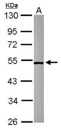 Anti-SMCR7 antibody [C1C3] used in Western Blot (WB). GTX120484