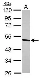 Anti-DDX47 antibody used in Western Blot (WB). GTX120497