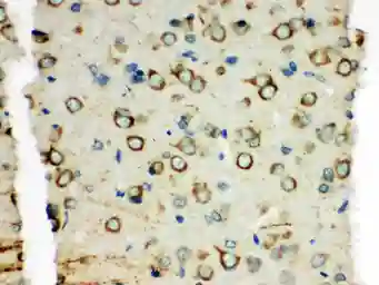 Anti-XRCC3 antibody used in IHC (Paraffin sections) (IHC-P). GTX12050