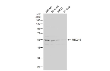 Anti-FBXL16 antibody [N2C3] used in Western Blot (WB). GTX120503