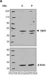 Anti-TRIT1 antibody [N1C1] used in Western Blot (WB). GTX120508