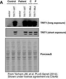 Anti-TRIT1 antibody [N1C1] used in Western Blot (WB). GTX120508