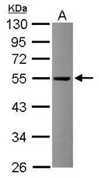 Anti-TRIT1 antibody [N1C1] used in Western Blot (WB). GTX120508
