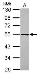 Anti-PARS2 antibody [C1C3] used in Western Blot (WB). GTX120510