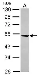 Anti-RASGEF1A antibody [C1C3] used in Western Blot (WB). GTX120514
