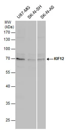 Anti-KIF12 antibody used in Western Blot (WB). GTX120529