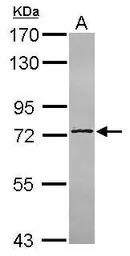 Anti-C14orf21 antibody used in Western Blot (WB). GTX120536