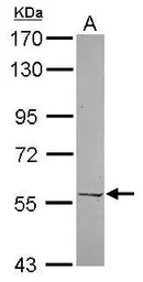 Anti-PRPF4 antibody [N3C3] used in Western Blot (WB). GTX120537