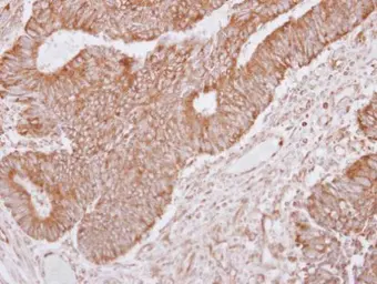 Anti-LRRC1 antibody [C1C3] used in IHC (Paraffin sections) (IHC-P). GTX120541