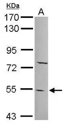 Anti-PYROXD2 antibody [N2C2], Internal used in Western Blot (WB). GTX120562