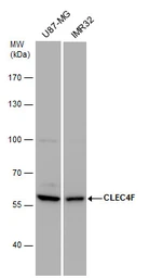 Anti-CLEC4F antibody used in Western Blot (WB). GTX120564