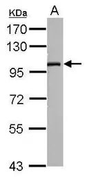 Anti-SLC9A8 antibody used in Western Blot (WB). GTX120569