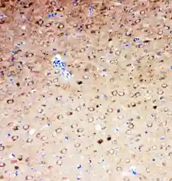 Anti-Serotonin Transporter antibody used in IHC (Paraffin sections) (IHC-P). GTX12057