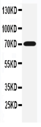 Anti-Serotonin Transporter antibody used in Western Blot (WB). GTX12057