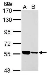 Anti-ILVBL antibody used in Western Blot (WB). GTX120588