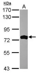 Anti-ASMTL antibody [N1C1] used in Western Blot (WB). GTX120590