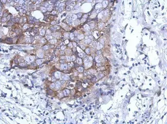 Anti-DDX59 antibody [N3C2], Internal used in IHC (Paraffin sections) (IHC-P). GTX120592