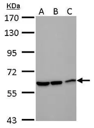 Anti-DDX59 antibody [N3C2], Internal used in Western Blot (WB). GTX120592