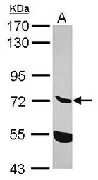 Anti-ENTPD7 antibody [N1N3] used in Western Blot (WB). GTX120593