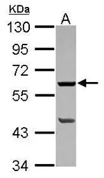 Anti-PLA2G4F antibody [N3C2], Internal used in Western Blot (WB). GTX120598