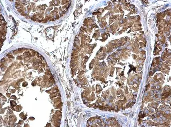 Anti-LZTR2 antibody used in IHC (Paraffin sections) (IHC-P). GTX120599