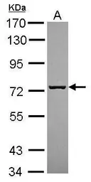Anti-SCFD1 antibody [N2C1], Internal used in Western Blot (WB). GTX120605