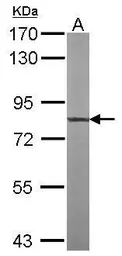 Anti-TTLL12 antibody [C1C3] used in Western Blot (WB). GTX120613