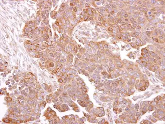 Anti-METTL13 antibody used in IHC (Paraffin sections) (IHC-P). GTX120626
