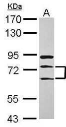 Anti-METTL13 antibody used in Western Blot (WB). GTX120626