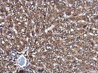 Anti-SMPD4 antibody used in IHC (Paraffin sections) (IHC-P). GTX120642