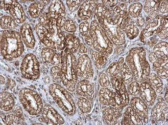 Anti-SMPD4 antibody used in IHC (Paraffin sections) (IHC-P). GTX120642