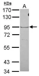 Anti-OXR1 antibody used in Western Blot (WB). GTX120649