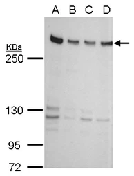 Anti-ZNF638 antibody used in Western Blot (WB). GTX120667
