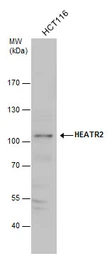 Anti-HEATR2 antibody used in Western Blot (WB). GTX120669