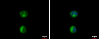 Anti-HEATR2 antibody used in Immunocytochemistry/ Immunofluorescence (ICC/IF). GTX120669