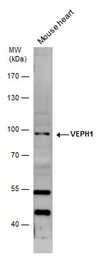 Anti-VEPH1 antibody used in Western Blot (WB). GTX120676