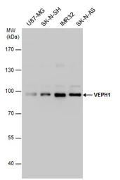 Anti-VEPH1 antibody used in Western Blot (WB). GTX120676