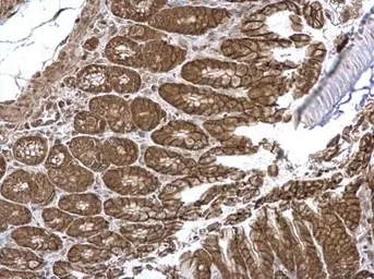 Anti-VEPH1 antibody used in IHC (Paraffin sections) (IHC-P). GTX120676
