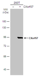 Anti-CXorf57 antibody used in Western Blot (WB). GTX120687